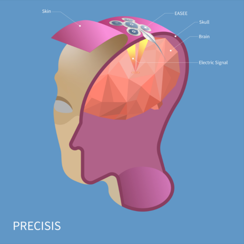 PRECISIS GmbH, Friday, September 23, 2022, Press release picture